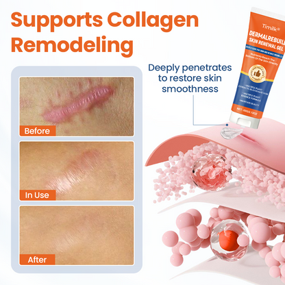 Timilk® DermalRebuild Skin Renewal Gel