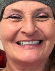 After image for Deborah Walker