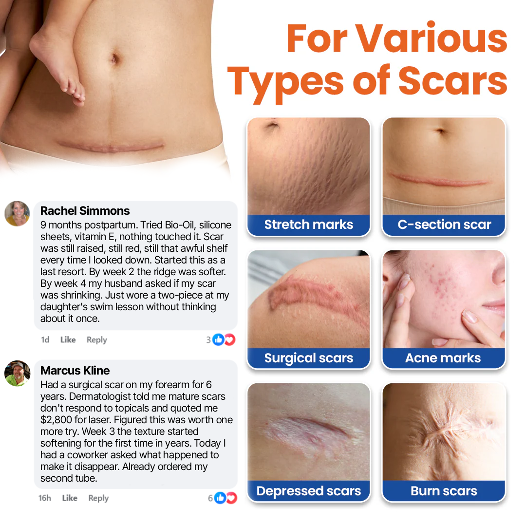 Timilk® DermalRebuild Skin Renewal Gel