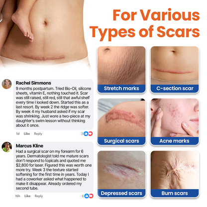 Timilk® DermalRebuild Skin Renewal Gel